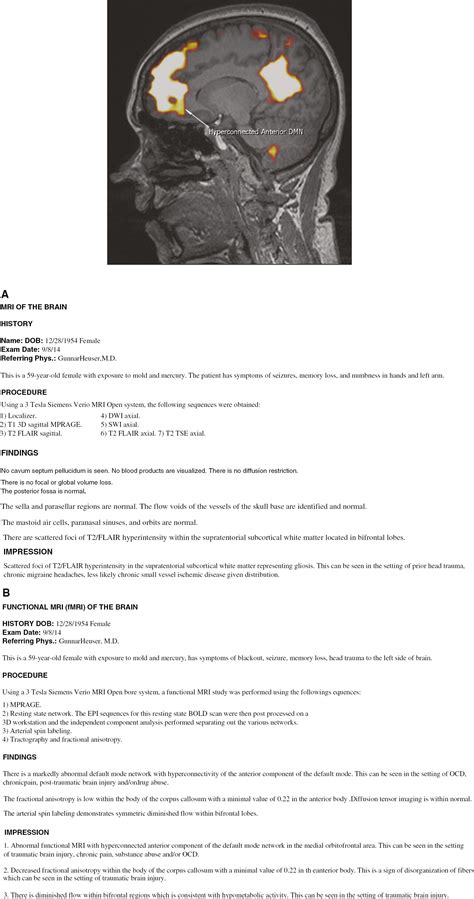 How to Read Your Radiology Report.